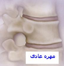 شرح بيماريها... پ