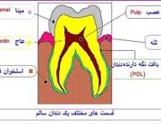 مراحل پُر کردن دندان(با تصاویر) مراحل پُر کردن دندان(با تصاویر)
