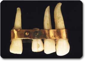 تاریخچه دندان پزشکی