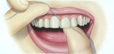 چرا استفاده از نخ دندان مهم است ؟