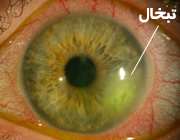 چرا تبخال می زنیم؟