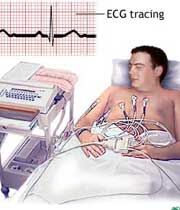 آزمایش های تشخیص بیماری قلبی