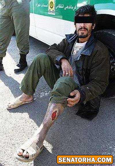 عکسهای تاسف بار از معتادین کراکی (18+)