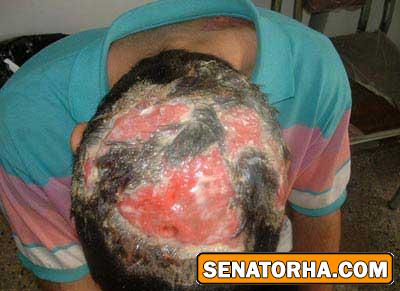 عکسهای تاسف بار از معتادین کراکی (18+)