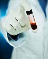 دانلود کتاب کم خونی فقر آهن