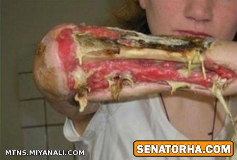 همه چیز در باره کراک و اعتیاد حتی بعداز 3 بار مصرف