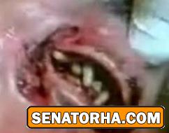 عکسهای تاسف بار از معتادین کراکی (18+)