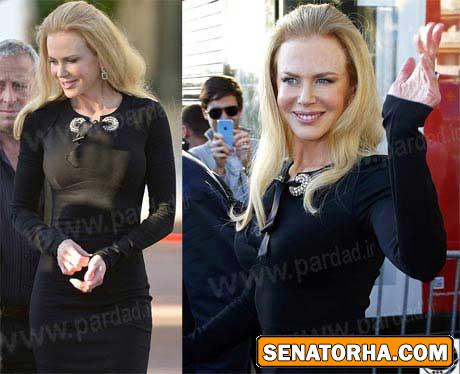 چهره جنجالی نیکول کیدمن خبرساز شد