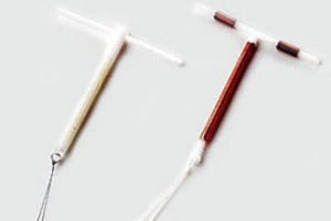 روش استفاده از iud چیست؟(جلوگیری از بارداری)